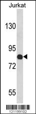 Anti-COMP Rabbit Polyclonal Antibody