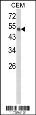 Anti-MAPKAPK3 Rabbit Polyclonal Antibody