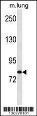 Anti-HUNK Rabbit Polyclonal Antibody (FITC (Fluorescein Isothiocyanate))