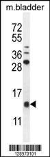 Anti-KTAP2 Rabbit Polyclonal Antibody (APC (Allophycocyanin))