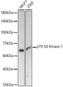 Western blot analysis of various lysates, using Anti-S6K1 Antibody [ARC57223] (A307700) at 1:1000 dilution