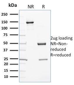 SDS-PAGE analysis of Anti-Cytochrome P450 3A1 Antibody [P6] under non-reduced and reduced conditions; showing intact IgG and intact heavy and light chains, respectively. SDS-PAGE analysis confirms the integrity and purity of the antibody