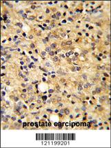 Anti-COMP Rabbit Polyclonal Antibody