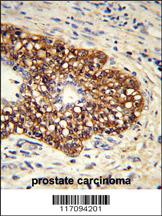 Anti-PTGIS Rabbit Polyclonal Antibody