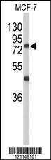 Anti-ADCK2 Rabbit Polyclonal Antibody