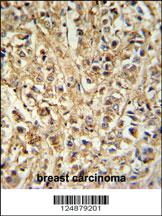 Anti-DDX6 Rabbit Polyclonal Antibody