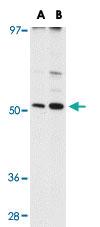 Anti-MATN3 Rabbit Polyclonal Antibody