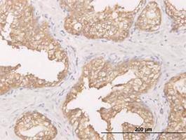 Anti-DCXR Mouse Monoclonal Antibody [clone: 6A6]