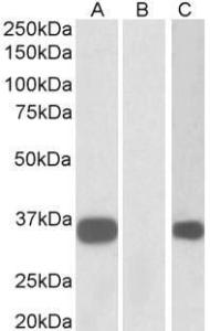 HEK293 lysate (10ug protein in RIPA buffer) overexpressing Human KCNIP3 with C-terminal MYC tag probed with Anti-KCNIP3 Antibody (A82683)