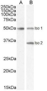 Anti-CHGA Goat Polyclonal Antibody