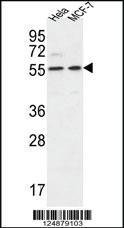 Anti-DDX6 Rabbit Polyclonal Antibody