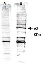 Anti-RAD52 Rabbit Polyclonal Antibody