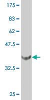 Anti-FOXF2 Mouse Monoclonal Antibody [clone: 4F8]