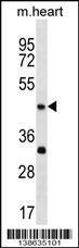 Anti-ACTL7B Rabbit Polyclonal Antibody