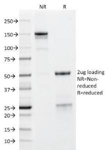 SDS-PAGE analysis of Anti-Glycoprotein 2 Antibody [GP2/1712] under non-reduced and reduced conditions; showing intact IgG and intact heavy and light chains, respectively. SDS-PAGE analysis confirms the integrity and purity of the Antibody