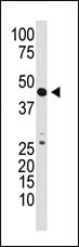 Anti-GDF3 Rabbit Polyclonal Antibody