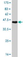 Anti-PRKCA Mouse Monoclonal Antibody [clone: 2F11]