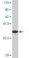 Anti-NLRP3 Mouse Monoclonal Antibody [clone: 3B1]