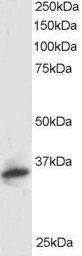 Anti-PSMF1 Antibody (A82685) staining (1 µg/ml) of Human Kidney lysate (RIPA buffer, 30 µg total protein per lane). Primary incubated for 1 hour. Detected by western blot using chemiluminescence