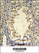 Anti-IMP3 Rabbit Polyclonal Antibody