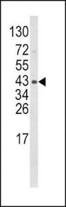 Anti-WNT5B Rabbit Polyclonal Antibody (PE (Phycoerythrin))