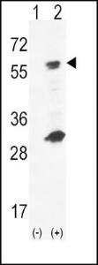 Anti-Hexokinase, Type IV Rabbit Polyclonal Antibody