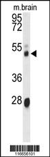 Anti-CYP3A43 Rabbit Polyclonal Antibody