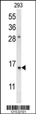 Anti-AURKA Rabbit Polyclonal Antibody