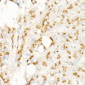 Immunohistochemistry analysis of paraffin-embedded human liver using Anti-S6K1 Antibody [ARC57223] (A307700) at a dilution of 1:200 (40x lens)