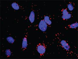 Anti-AKT1 + NOS3 Antibody Pair