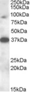 EB08235 (0.3 µg/ml) staining of Rat Testis lysate (35 µg protein in RIPA buffer). Primary incubation was 1 hour. Detected by chemiluminescence.