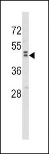 Anti-WNT10B Rabbit Polyclonal Antibody