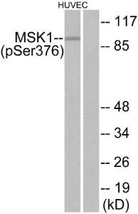 Western blot analysis of lysates from HUVEC cells treated with PMA 125 ng/ml 30' using Anti-MSK1 (phospho Ser376) Antibody. The right hand lane represents a negative control, where the Antibody is blocked by the immunising peptide