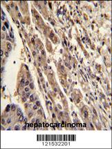 Anti-REG3A Rabbit Polyclonal Antibody