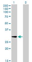 Anti-GALNT12 Mouse Polyclonal Antibody