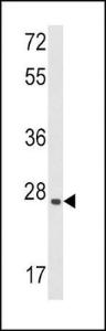 Anti-LIF Rabbit Polyclonal Antibody (Biotin)