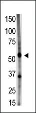 Anti-GDF5 Rabbit Polyclonal Antibody