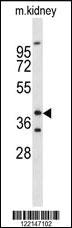 Anti-FOXL1 Rabbit Polyclonal Antibody