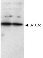 Anti-SFRP1 Rabbit Polyclonal Antibody