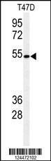 Anti-KTEL1 Rabbit Polyclonal Antibody (HRP (Horseradish Peroxidase))