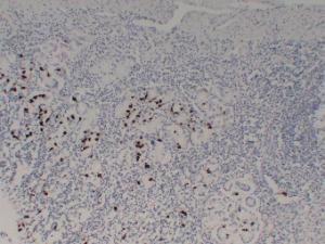 Immunohistochemical analysis of paraffin-embedded human Stomach using Anti-Gastrin Antibody