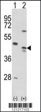 Anti-AGER Rabbit Polyclonal Antibody