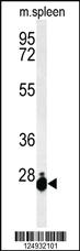 Anti-THOC7 Rabbit Polyclonal Antibody