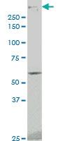 Anti-PRKDC Mouse Monoclonal Antibody [clone: 1B9]