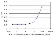 Anti-SELE Polyclonal Antibody Pair