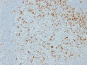 Anti-Proliferation antibody