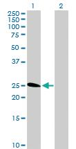 Anti-TNFRSF18 Rabbit Polyclonal Antibody