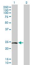 Anti-PTTG2 Rabbit Polyclonal Antibody