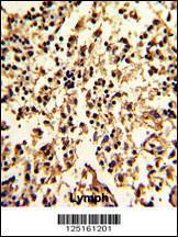 Anti-SERPINA9 Rabbit Polyclonal Antibody (PE (Phycoerythrin))