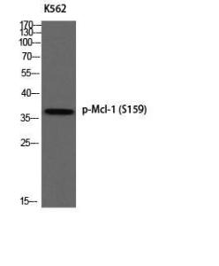 Anti-MCL1